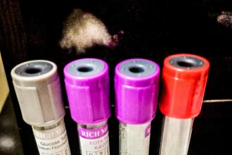 Laboratory test tubes arranged in a rack at a medical laboratory
