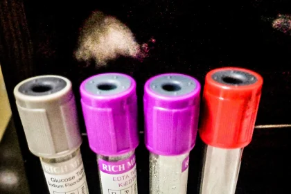 Laboratory test tubes arranged in a rack at a medical laboratory